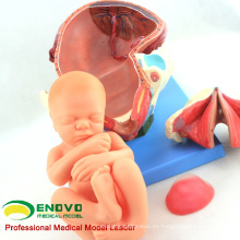 VENDER 12470 El procedimiento de entrega del parto humano consiste en un modelo de anatomía